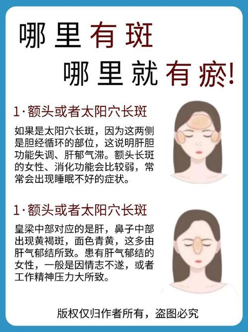 女人的额头上长斑是什么原因引起的 作息不规律
