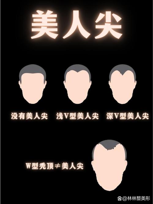 一般什么人会有美人尖 美人尖详解