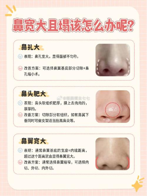 塌鼻子面相，男女塌鼻子面相解读