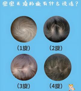 男孩头上有两个旋好吗