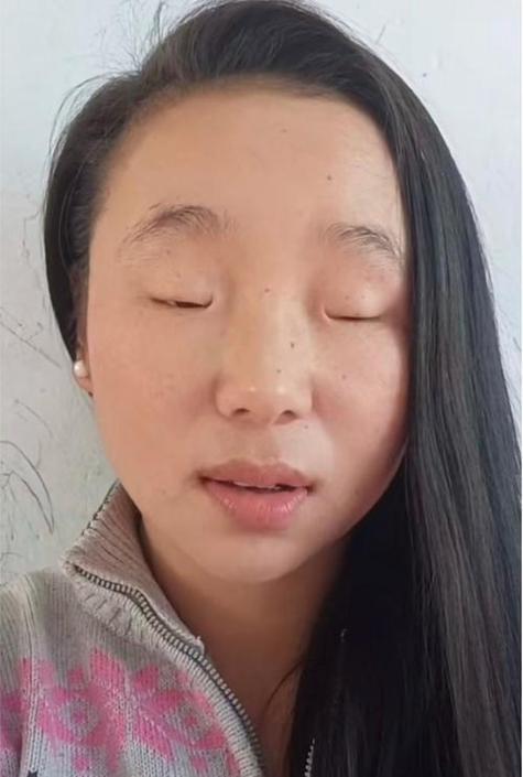 眼睛短小的人命苦