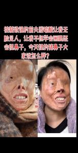 捏鼻子毁了多少人 富贵命的鼻子什么样