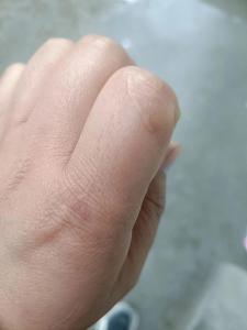 女生左手食指有疤的传说