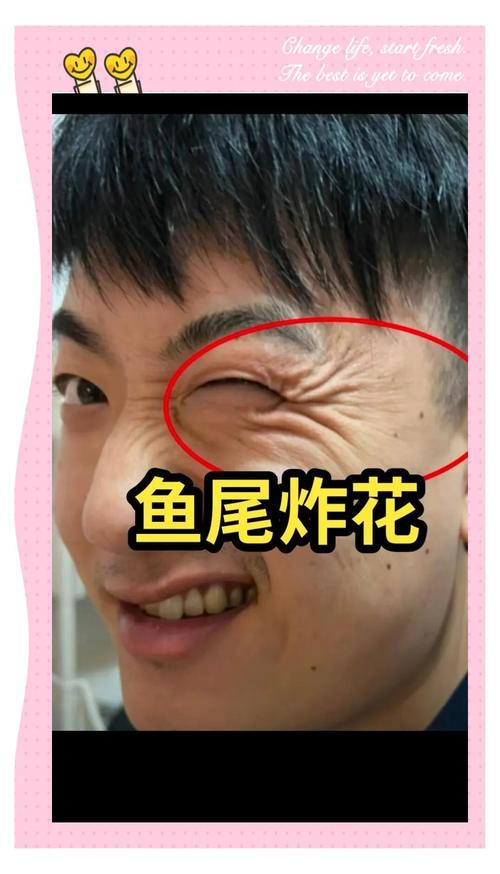 天生鱼尾纹的命运 男人鱼尾纹预示着什么