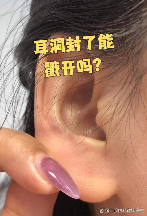 耳洞封了福气会来吗