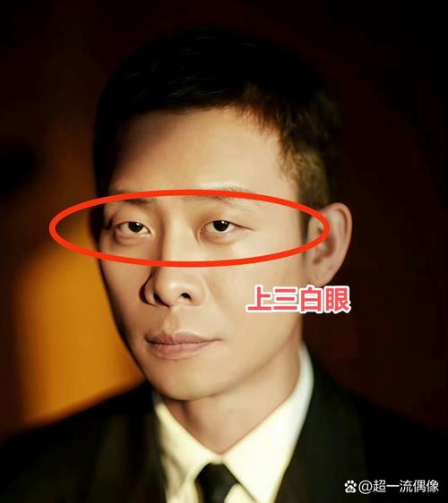 三白眼又叫美人眼,什么是三白眼