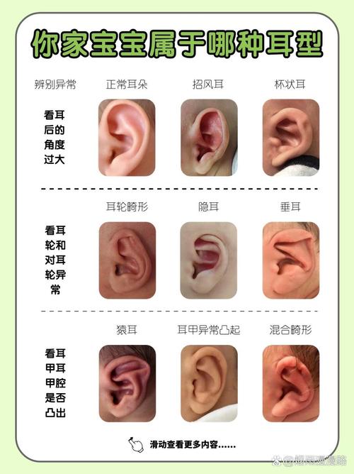各种耳朵形状解说,耳朵有哪几种形状图