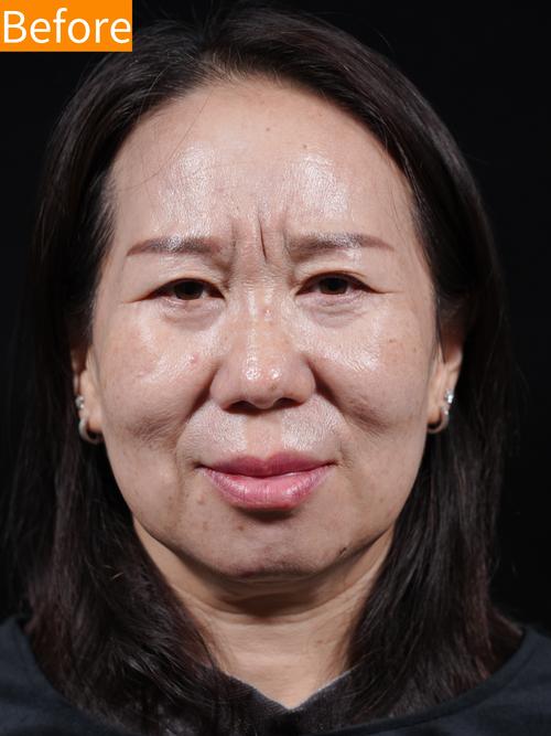 川字纹对女人有啥影响