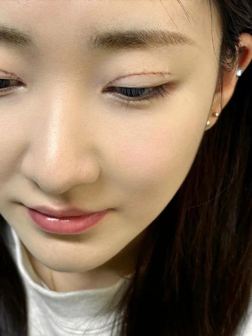 双眼皮的女孩是什么样的人