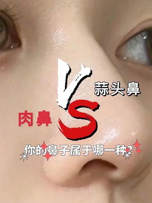 肉鼻子和蒜头鼻区别