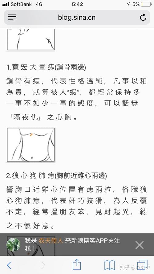狼心狗肺痣的位置在哪