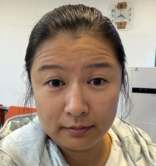 具有有抬头纹的女人面相 感情运势欠佳