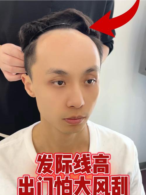 发际线高的男人   晚年财运好