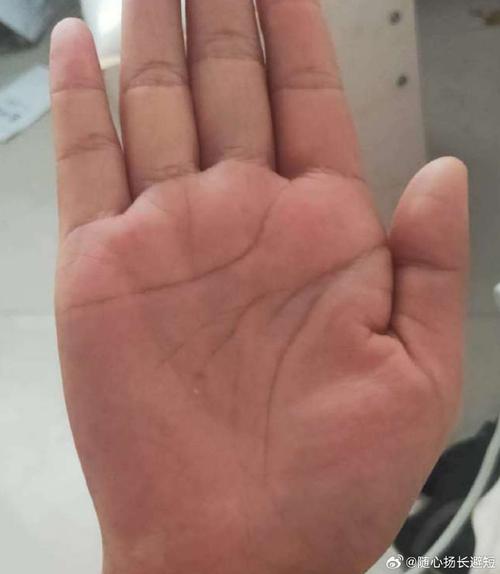 智慧线过长往下弯