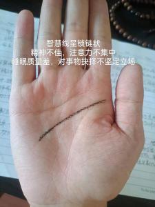 智慧线呈锁状波浪状指示了什么?