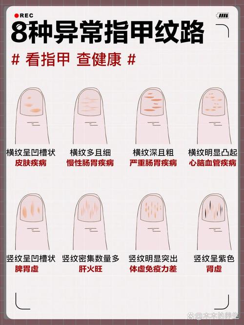手相知识 手指甲颜色看身体健康