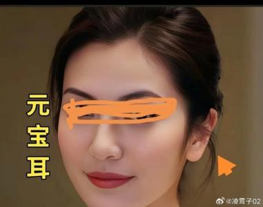 元宝耳朵什么样子 元宝耳十分聚财