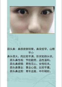 面相解析：蒜头鼻