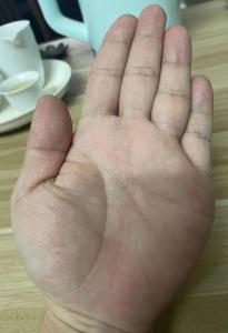 金形手的特征