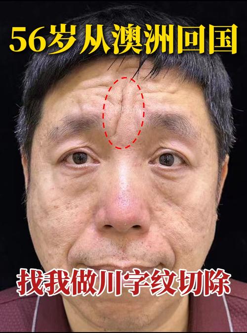 额头有两条皱纹的面相分析