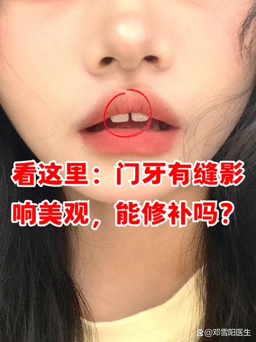 门牙有缝的女人命运如何