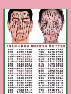 鼻子上有痣好不好,鼻子上有痣代表什么?