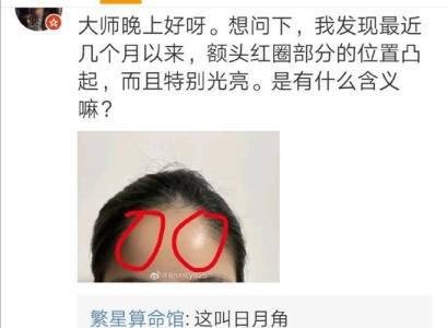 日月角发达意味着父母健康吗