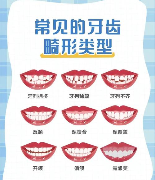 面相牙齿&nbsp;牙齿稀疏的女人好吗