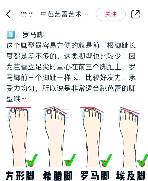 女人罗马脚有什么说法