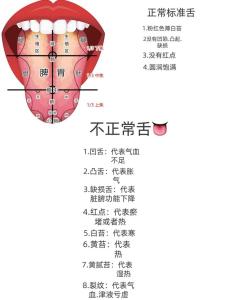 舌头分析你的命运与前途