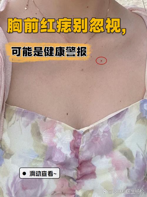胸前有红痣的命理情况
