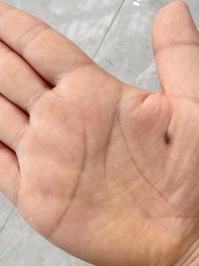 生男生女 手心有痣的人容易生男孩还是女孩