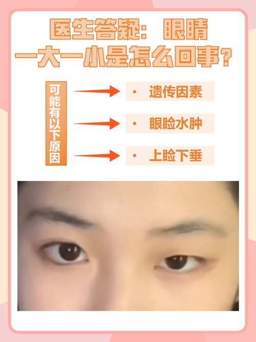 眼睛一大一小面相，有什么影响