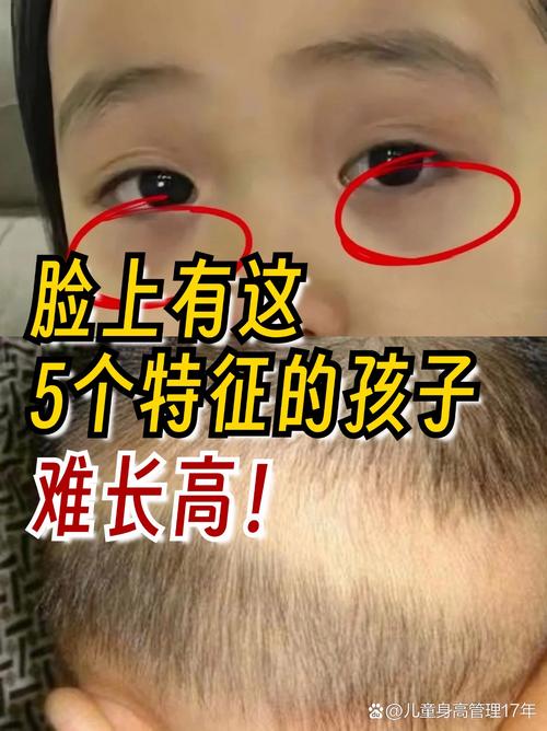 最让父母没辄的小孩面相