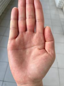 断掌的人是否短命