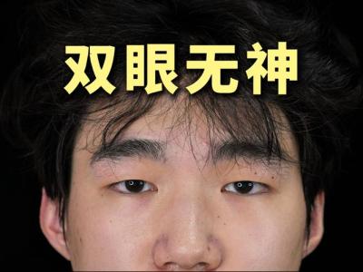 极端聪明人的面相 内双眼皮聪明过人