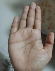 女人手掌厚福多吗