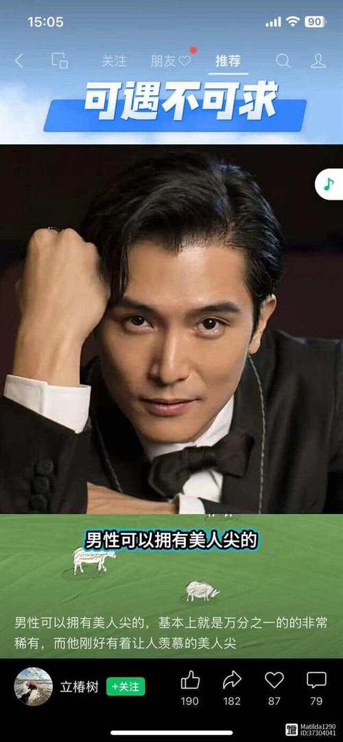 男人有美人尖是好是坏呢，需要剃掉吗