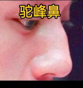 鼻梁有节面相