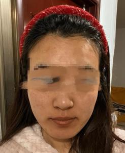 面部黄肿：面相学气色发黄、皮肤发黄、黄肿命理