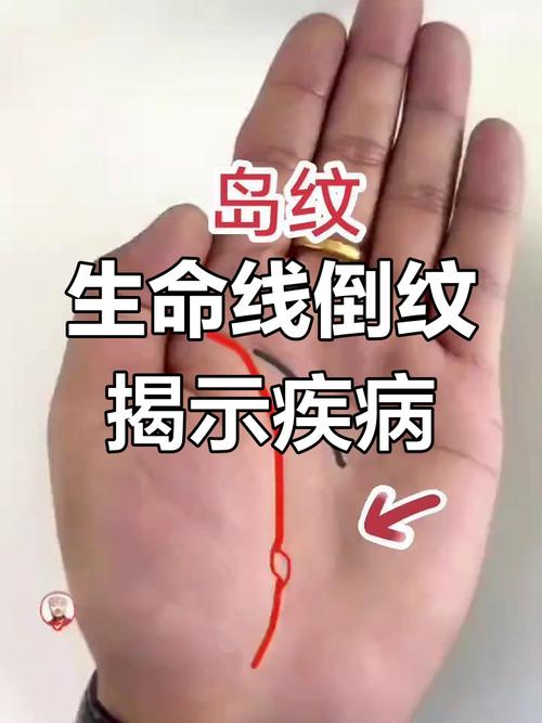 生命线中断或出现岛纹的人易有危险吗