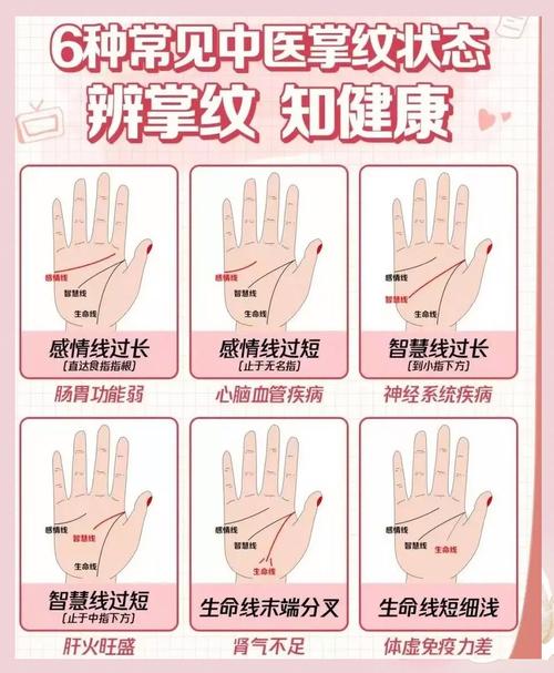 掌纹看健康有科学依据吗