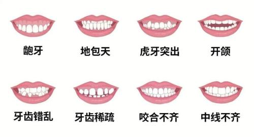 牙齿参差不齐的面相 好不好