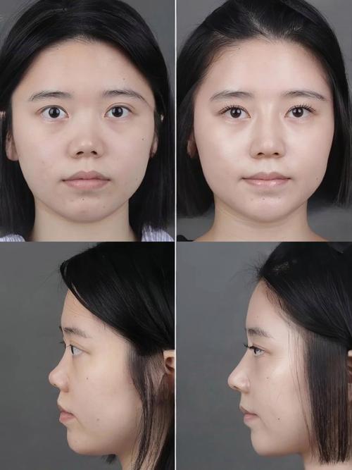 鼻子短面相怎样呢