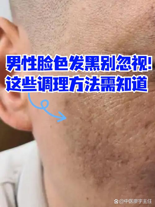 肾虚男人面相 颧骨灰黑色
