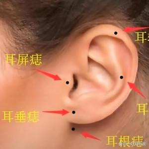 女人面相痣图 耳珠痣财运旺盛