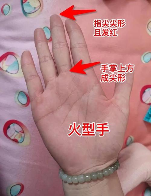 脾气火爆的手相