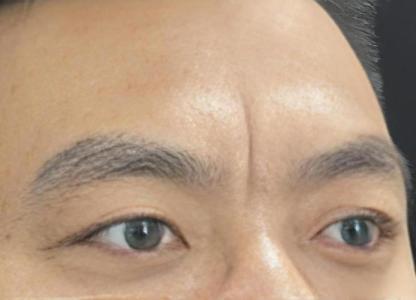 额头印堂有竖纹，难生儿