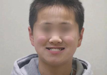 什么是地包天面相 地包天的人都很丑吗