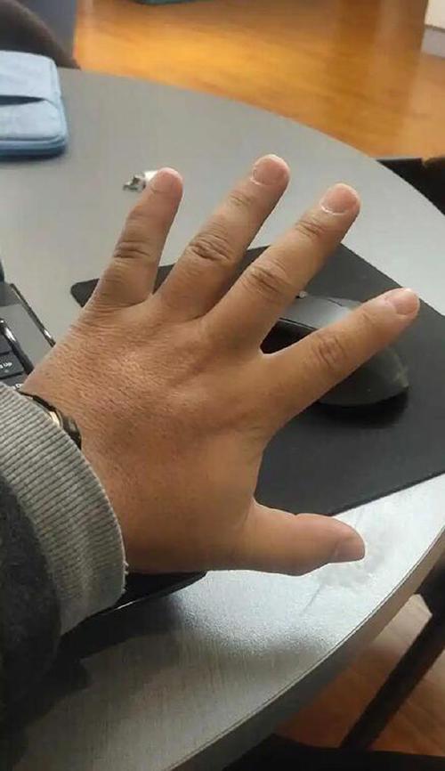 男人手掌厚实手指又短